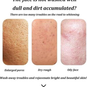 Whitening Facial Cleanser Result Before After Saudi