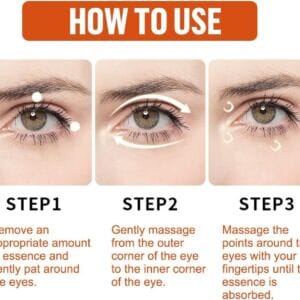 Milia Remover Essential UAE