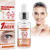 Milia Remover Essential Saudi Arabia